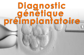 Diagnostic génétique préimplantatoire