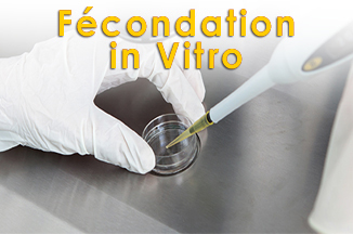 Fecondation in vitro