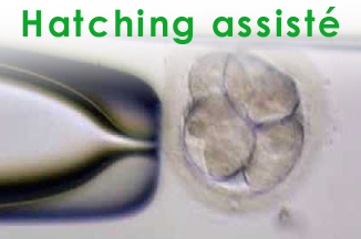 Hatching assisté