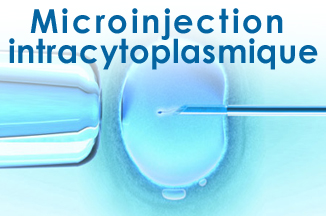 Microinjection intracytoplasmique